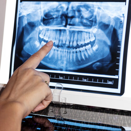Oral Diagnoz ve Radyoloji tedavi