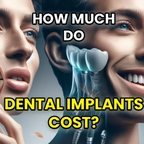 how-much-do-dental-implants-cost