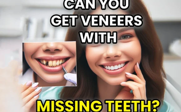 can you get veneers with missing teeth