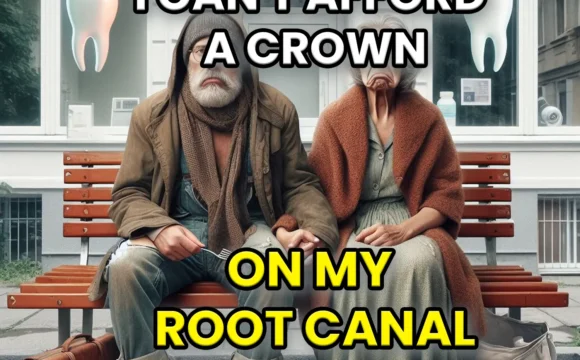 I-Cant-Afford-a-Crown-on-My-Root-Canal